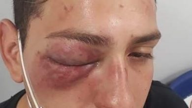 Kevin | joven golpeado por carabineros | brutal golpiza de carabineros
